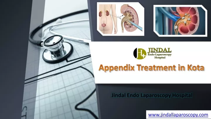 appendix treatment in kota
