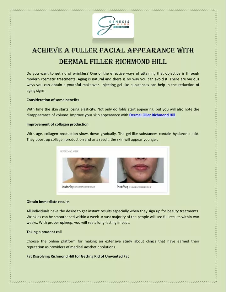 achieve a fuller facial appearance with dermal