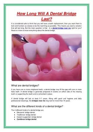 how long will a dental bridge last
