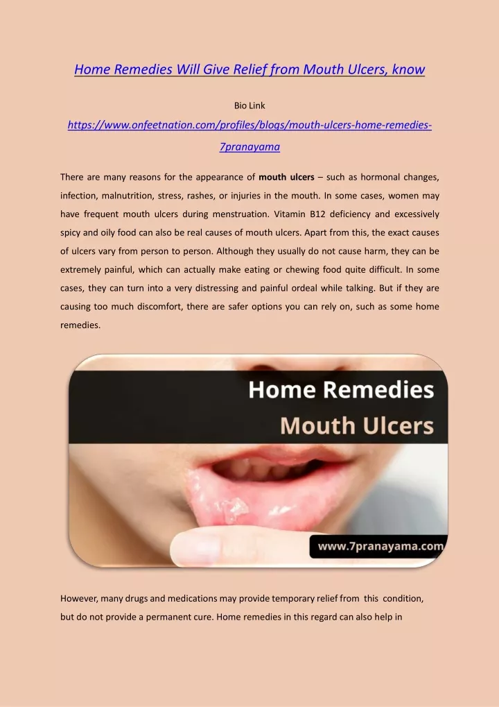 home remedies will give relief from mouth ulcers