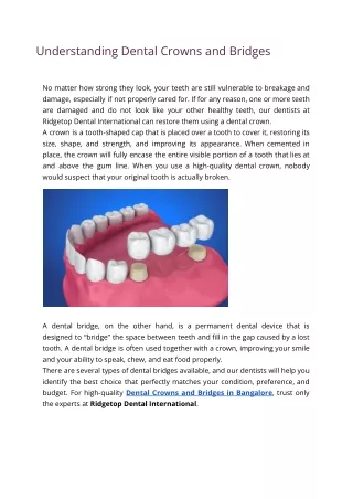 understanding dental crowns and bridges