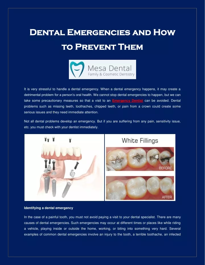 dental emergencies and how dental emergencies