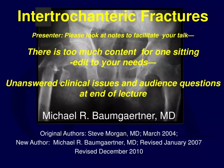 intertrochanteric fractures presenter please look