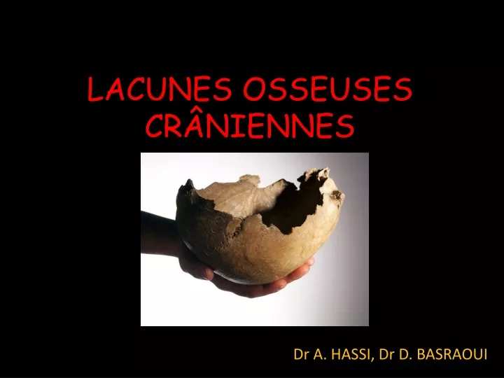 lacunes osseuses cr niennes