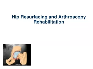 Hip Resurfacing and Arthroscopy Rehabilitation