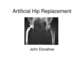 Artificial Hip Replacement