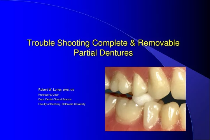 trouble shooting complete removable partial dentures