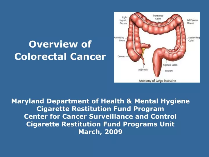 overview of colorectal cancer