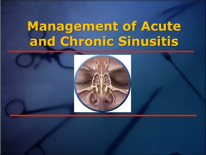 management of acute and chronic sinusitis