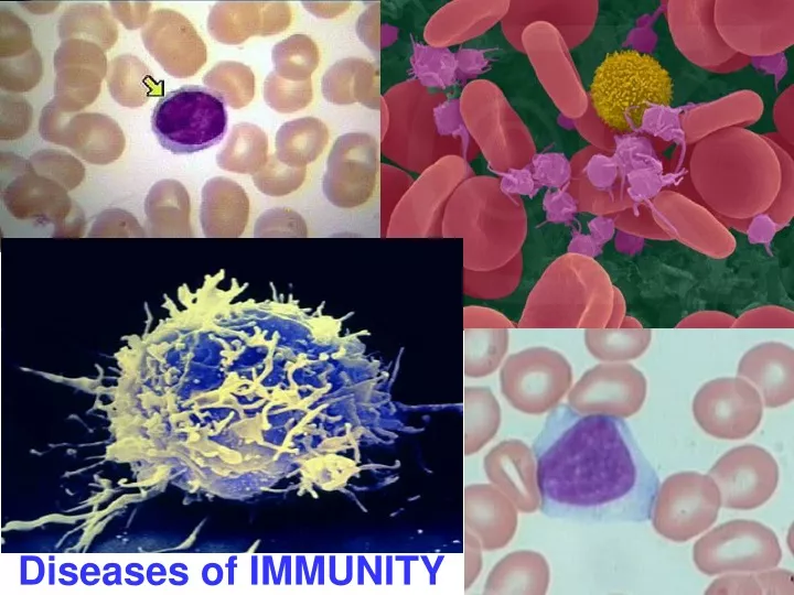 diseases of immunity