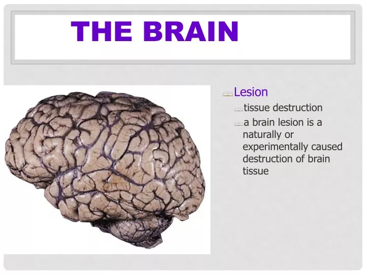 the brain