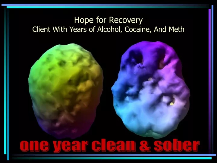 hope for recovery client with years of alcohol cocaine and meth