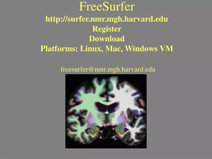 freesurfer http surfer nmr mgh harvard edu register download platforms linux mac windows vm