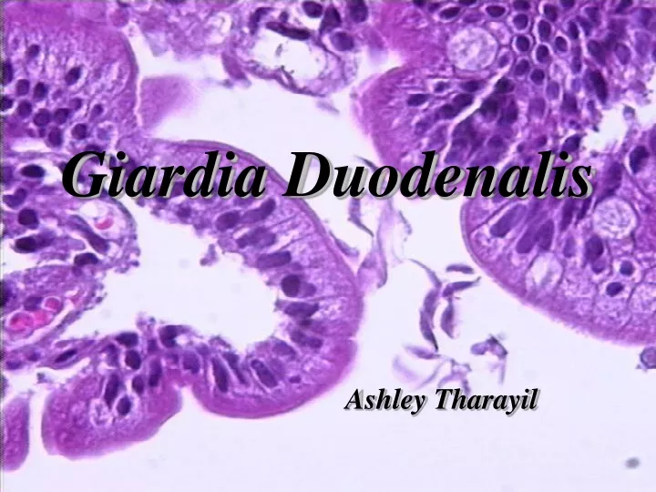 giardia duodenalis