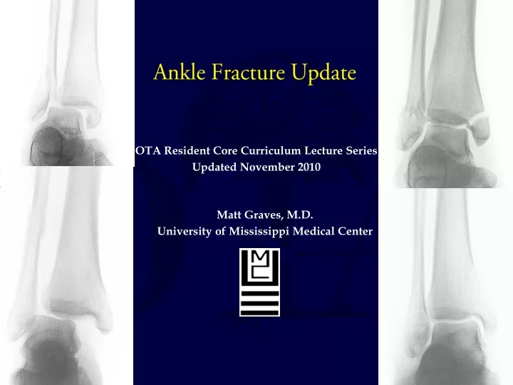 ankle fracture update