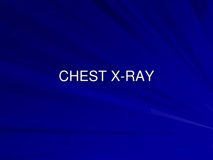 chest x ray