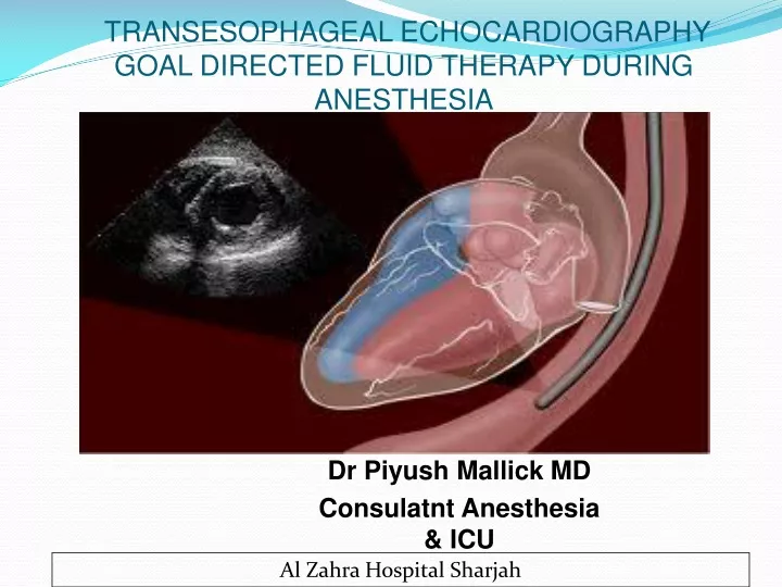 transesophageal echocardiography goal directed fluid therapy during anesthesia