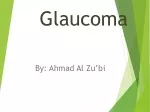 Glaucoma - slide 1