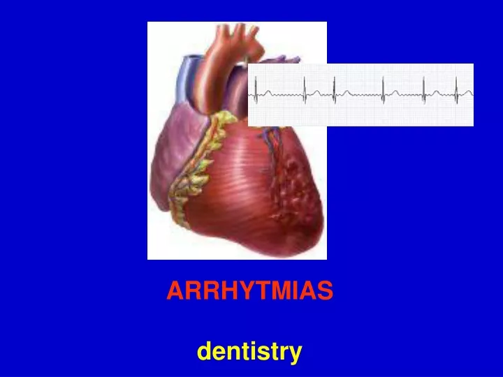 arrhytmias dentistry