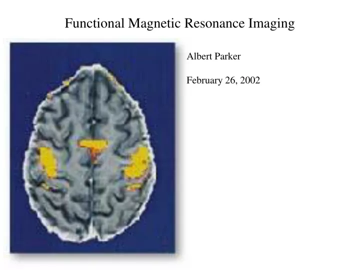 functional magnetic resonance imaging