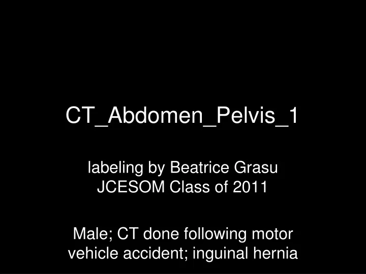 ct abdomen pelvis 1