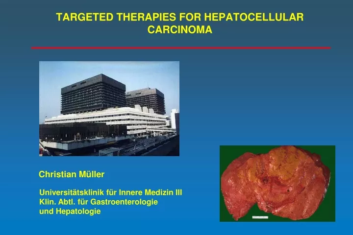 targeted therapies for hepatocellular carcinoma