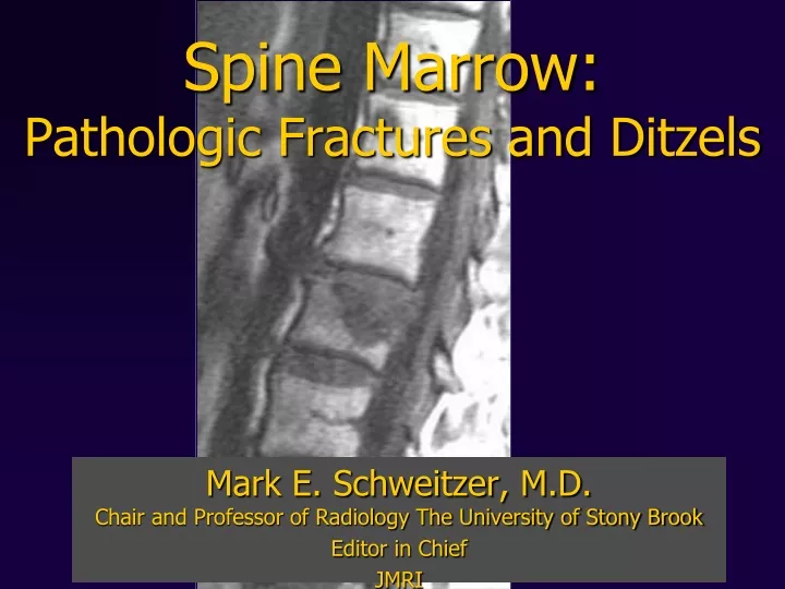 spine marrow pathologic fractures and ditzels