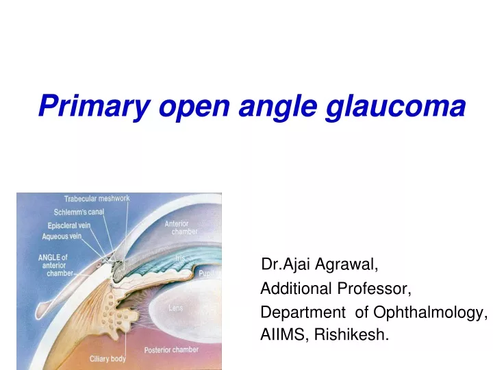 primary open angle glaucoma