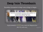 PPT - Deep Vein Thrombosis PowerPoint Presentation, free download - ID ...