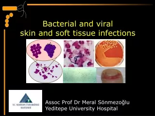 Bacterial and viral  skin and soft tissue  infections