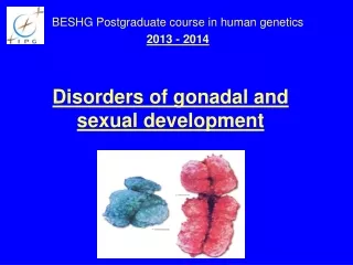 Disorders of gonadal and sexual development