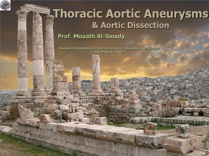 thoracic aortic aneurysms aortic dissection