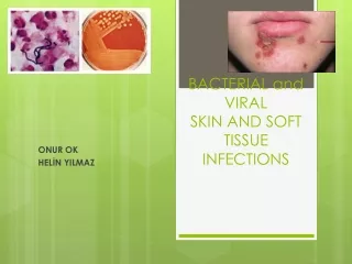 BACTERIAL and VIRAL  SKIN AND SOFT TISSUE INFECTIONS