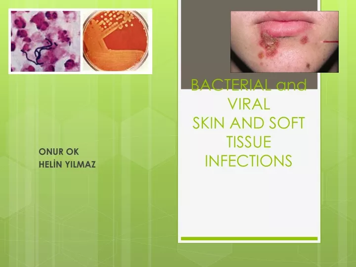 bacterial and viral skin and soft tissue infections