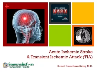 Acute Ischemic Stroke &amp; Transient Ischemic Attack (TIA) Sumet Preechawuttidej, M.D.
