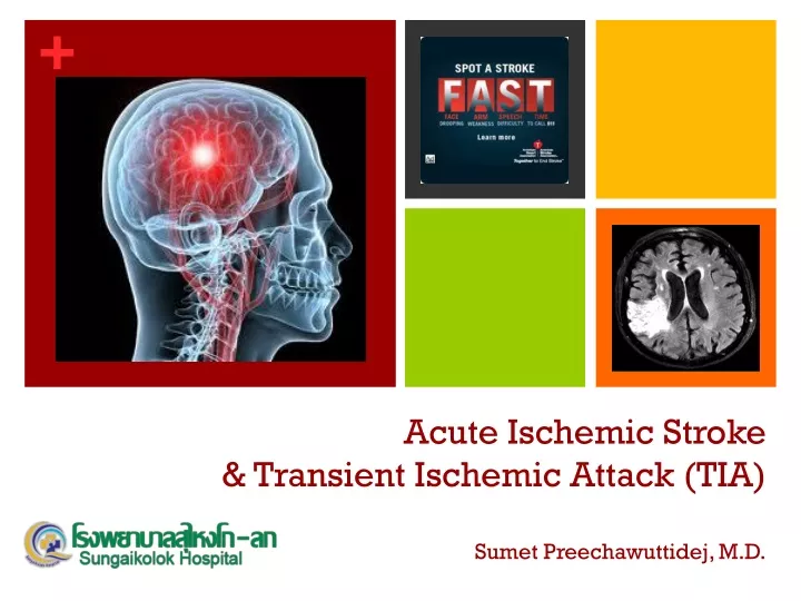 acute ischemic stroke transient ischemic attack tia sumet preechawuttidej m d