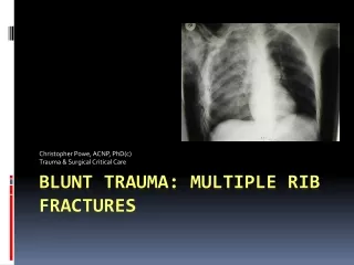 Blunt Trauma: Multiple Rib Fractures