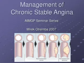 Management of  Chronic Stable Angina