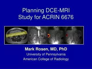 Planning DCE-MRI Study for ACRIN 6676