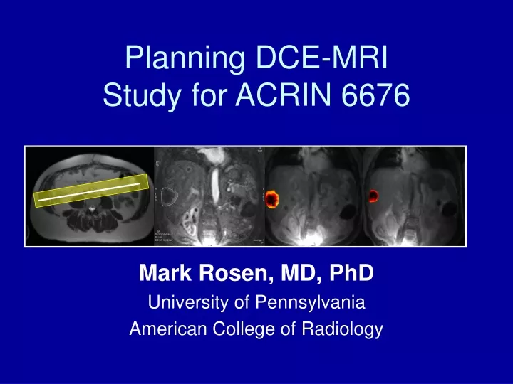 planning dce mri study for acrin 6676