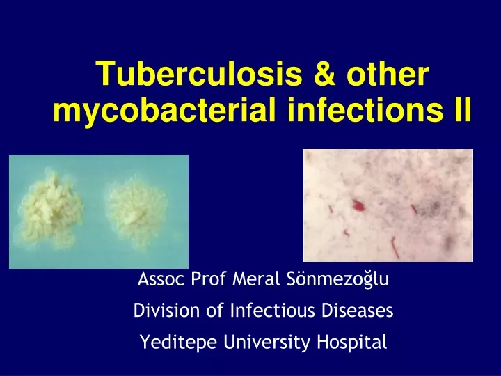 tuberculosis other mycobacterial infections ii