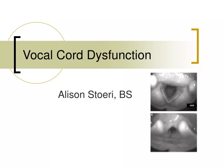 vocal cord dysfunction