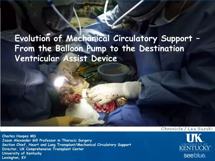 evolution of mechanical circulatory support from