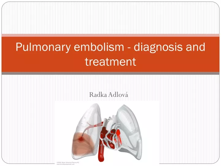 pulmonary embolism diagnosis and treatment