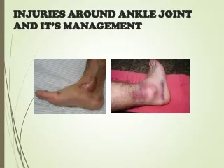 INJURIES AROUND ANKLE JOINT AND IT’S MANAGEMENT