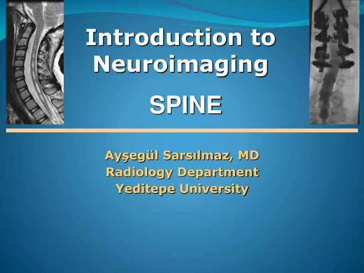 introduction to neuroimaging