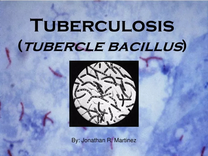 tuberculosis tubercle bacillus