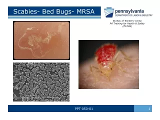 Scabies- Bed Bugs- MRSA