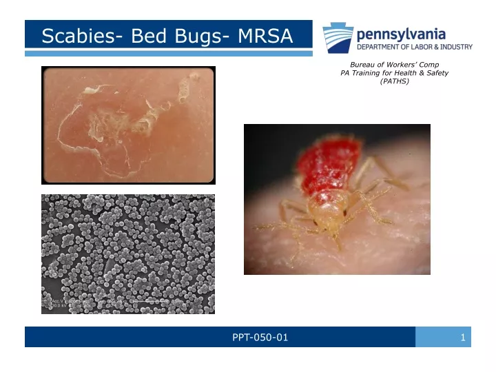 scabies bed bugs mrsa