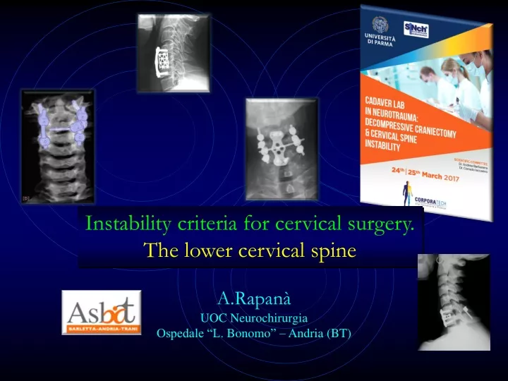 instability criteria for cervical surgery
